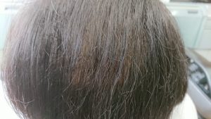 増毛後