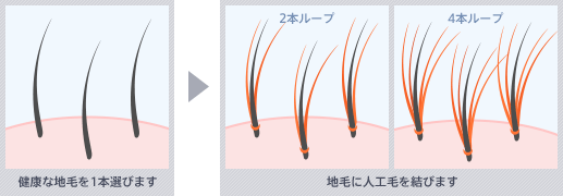 増毛施術5,500円キャンペーン